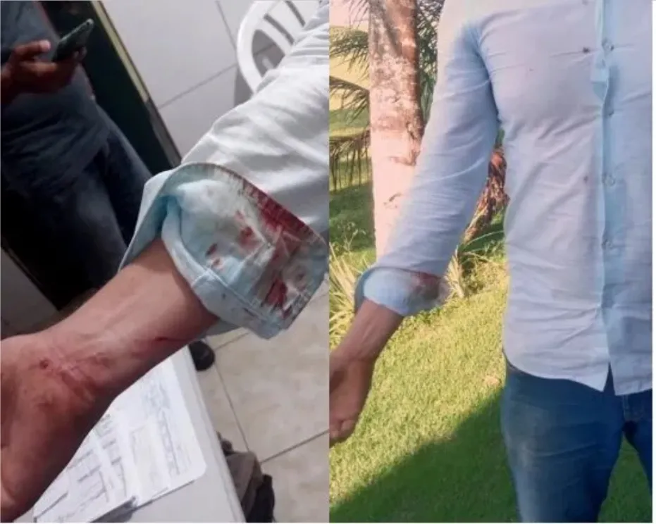 dosa é baleada durante tiroteio em Valença; Outro confronto também foi registrado